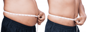 Who is a Candidate for Weight-Loss Drugs?