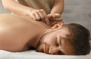 Acupuncture for Sports Injuries