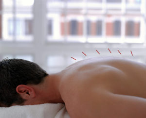 Health Conditions Treated With Acupuncture