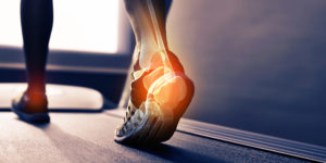 Tips to Avoid Athletic Injuries and What to do if you are Injured