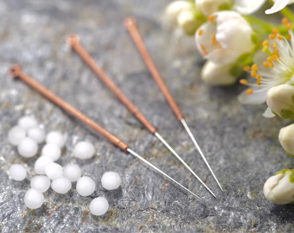 What To Expect At Acupuncture Treatment - Premierechiro