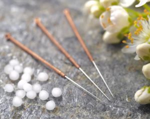 What To Expect At Acupuncture Treatment