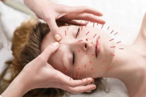 Acupuncture Therapy and Insomnia