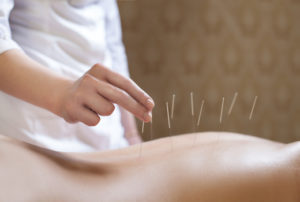 Acupuncture vs. Opioids for Pain Relief