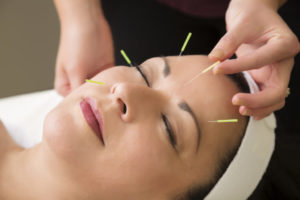 Reasons Why Acupuncture Relieves Stress and Anxiety