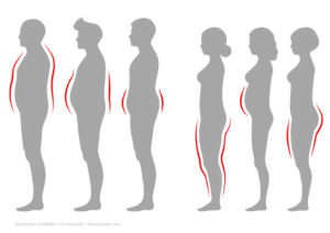 Major weight loss—whether from surgery or diet—has same metabolic benefits