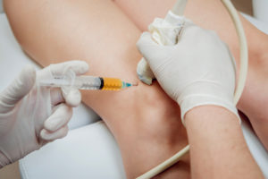 PRP Injections Revolutionize Pain Management