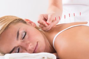 Different Types of Acupuncture